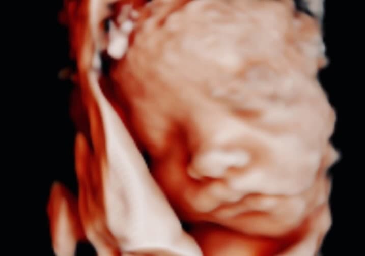 Ultrasound image