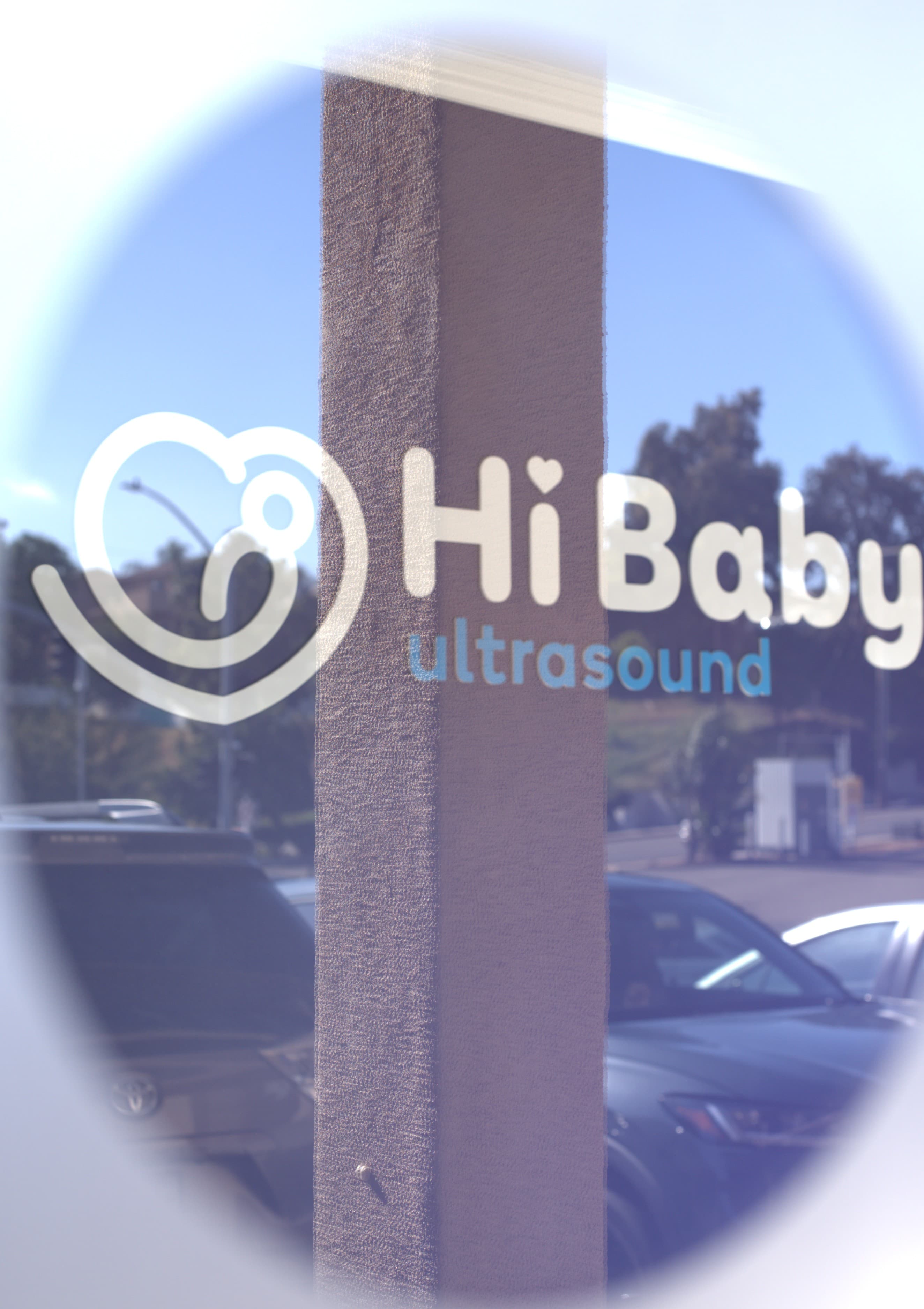 Ultrasound image 2