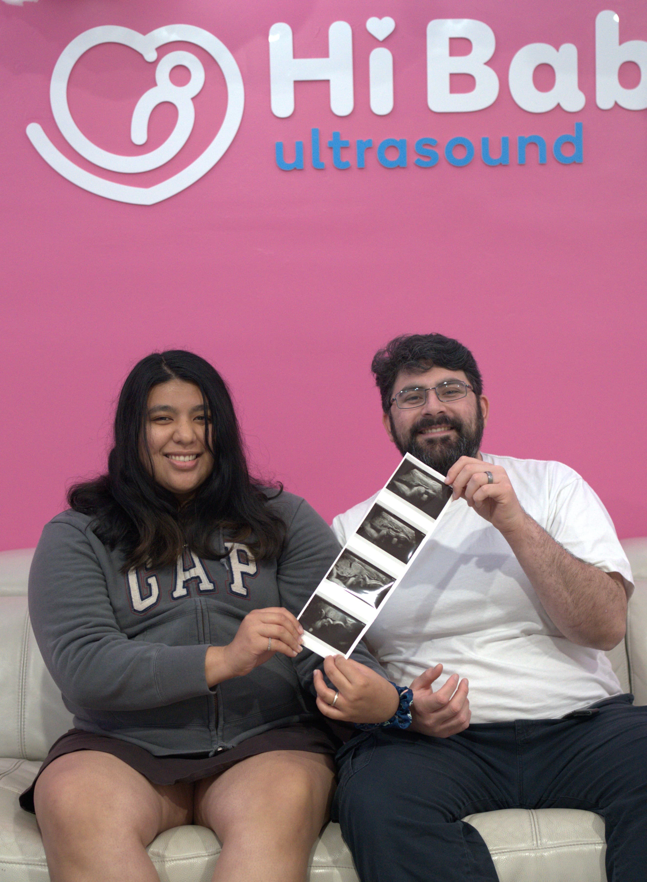 Ultrasound image 20