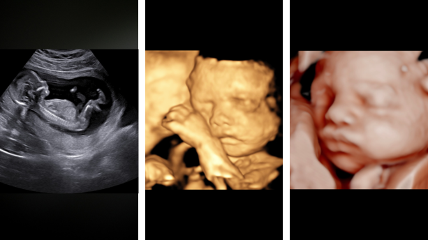 See Baby in Color plus